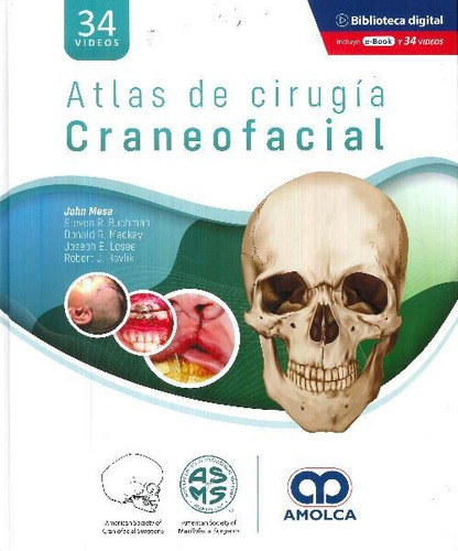 Libro Atlas De Cirugía Craneofacial De John Mesa