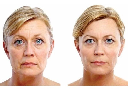 Imagen 3 de 8 de Crema Nutritiva Vitaminas A Y E 160g Laca