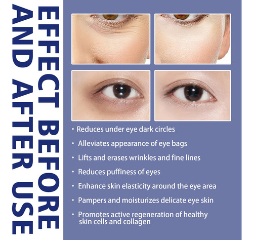 H Aclara Las Ojeras, Bolsas Debajo De Los Ojos, Elástico, Re