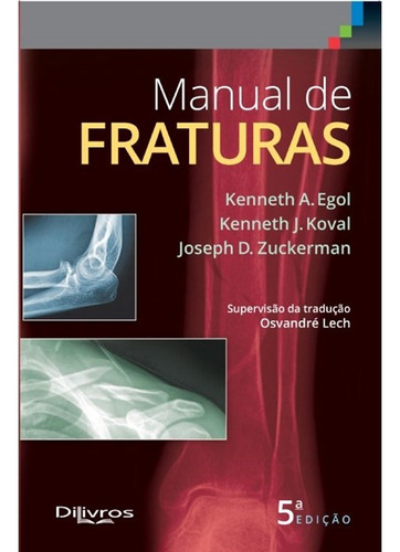 Manual De Fraturas: Não Aplica, De Kenneth A Egol Kenneth J Koval Joseph D Zuckerman. Editora Di Livros Em Português
