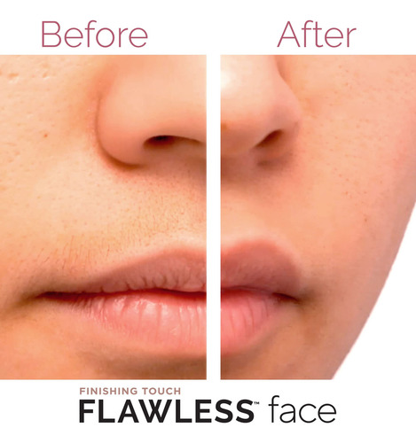 Eliminador De Vello Flawless Para Mujer Blanco/rosado