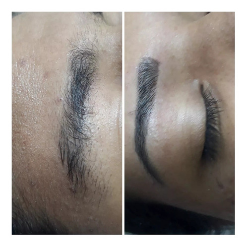 Imagem 4 de 5 de Estética