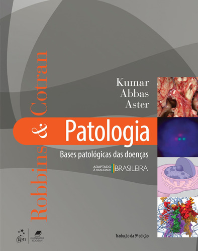 Robbins & Cotran Patologia - Bases Patológicas das Doenças, de V Kumar. Editora Gen – Grupo Editorial Nacional Part S/A, capa mole em português, 2016