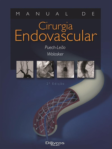 Livro: Manual De Cirurgia Endovascular