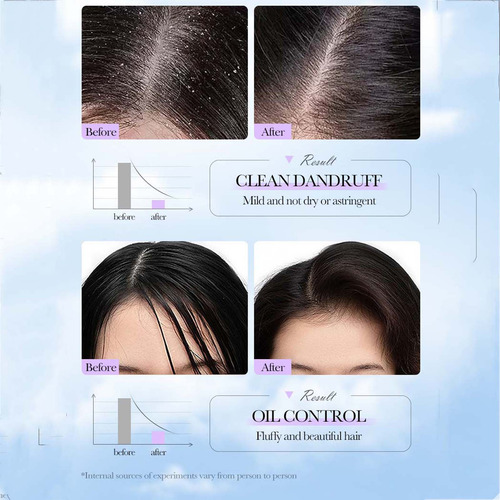 Sabonete De Limpeza Anticaspa Antiitch Shampoo Sabonete 60g