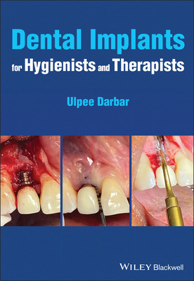Libro Dental Implants For Hygienists And Therapists - Dar...