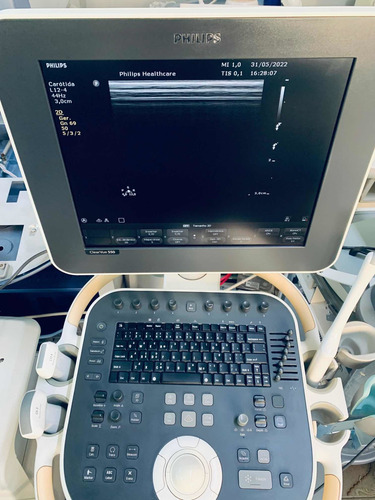 Ultrassom Philips Clearvue 550 Gineco Obstetrícia Vascular