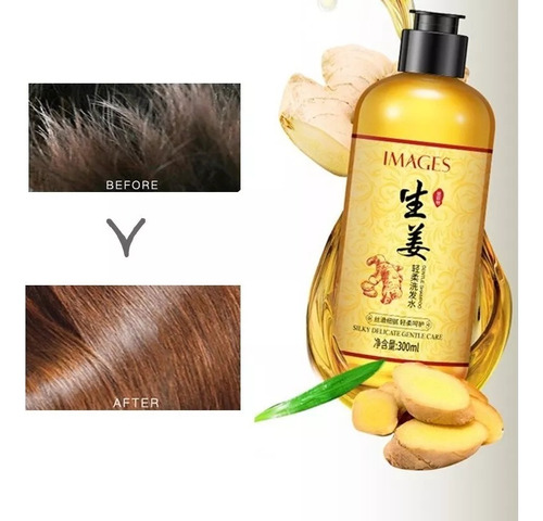 12 Shampoo Jengibre Anti Caida Crecimiento Reparador Images