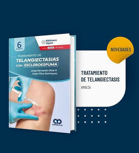 Tratamiento De Telangiectasias Con Escleroespuma +e-book  