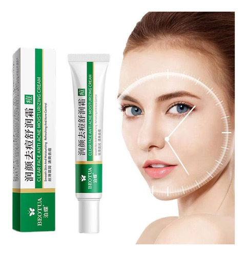 03 Creme Tratamento Eficaz Para Acne E Espinhas Oleosa Dia/noite