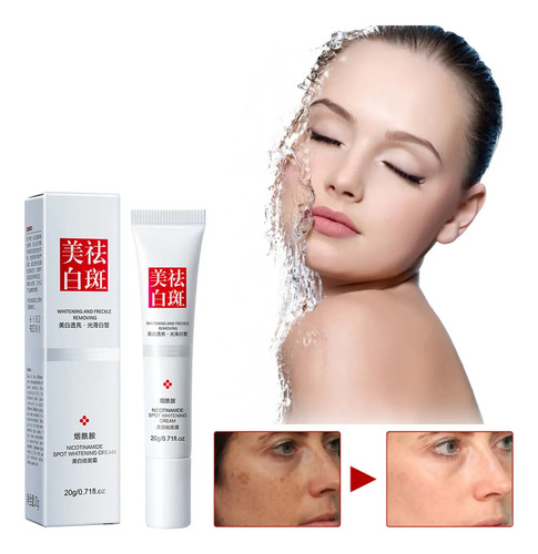 C Eliminador De Manchas Oscuras, Melasma, Pecas, Sol, Crema