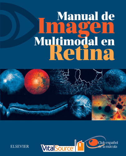 Libro Electrónico Manual De Imagen Multimodal En Retina