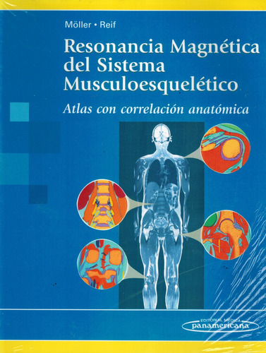 Resonancia Magnética Del Sistema Musculoesquelético - Möller