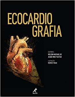 Ecocardiografia