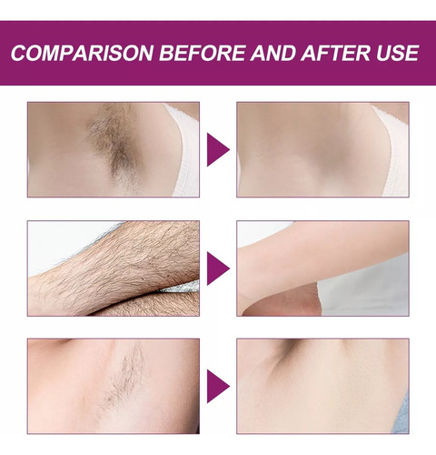 Crema Depilatoria Xin Son Espuma 150 Ml Cuerpo.
