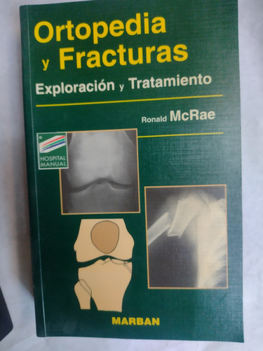 Ortopedia Y Fracturas. Exploración Y Tratamiento. Mcrae