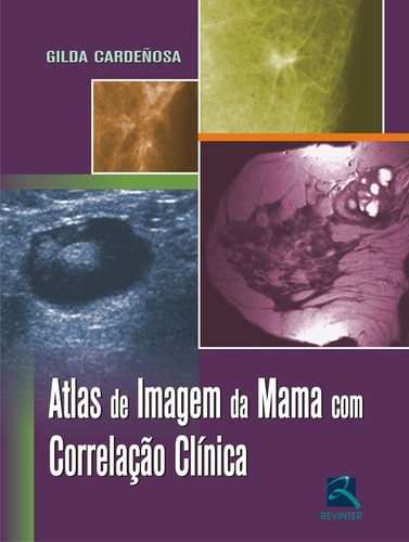 Atlas De Imagem Da Mama Com Correlação Clínica, De Gilda Cardeñosa. Editora Revinter, Capa Mole Em Português, 2009