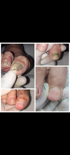 Imagen 1 de 5 de Pedicuria