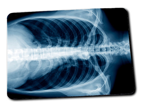 Mouse Pad Radiografía Tórax