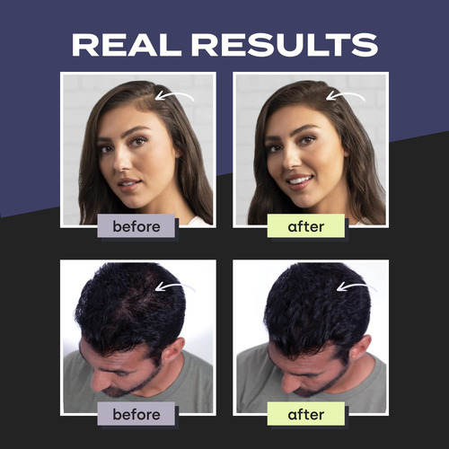 Fibras Para Construcción De Cabello, Relleno Capilar Instant