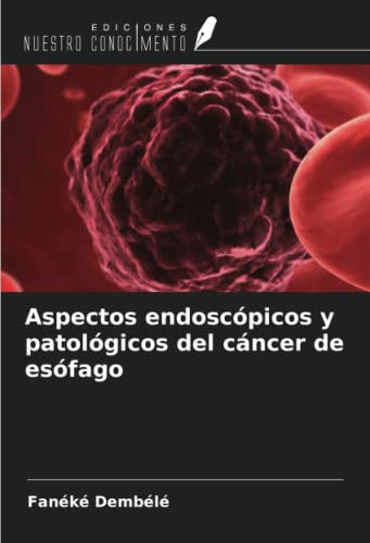 Aspectos Endoscopicos Y Patologicos Del Cancer De Esofago