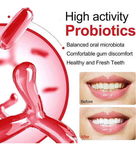 Pasta De Dientes Blanqueadora Con Probióticos Sp-10 Ultra
