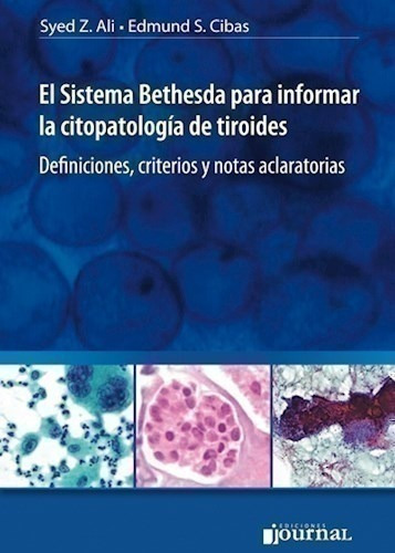 El Sistema Bethesda Para Informar La Citopatología De Tiroi