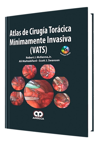 Atlas De Cirugía Torácica Mínimamente Invasiva (vats).