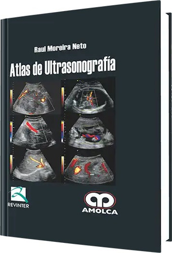 Atlas De Ultrasonografía