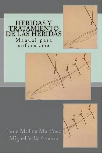 Heridas Y Tratamiento De Las Heridas : Manual Para Enfermer A, De Irene Molina Martinez. Editorial Createspace Independent Publishing Platform, Tapa Blanda En Español