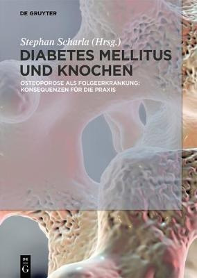 Diabetes Mellitus Und Knochen : Osteoporose Als Folgeerkr...