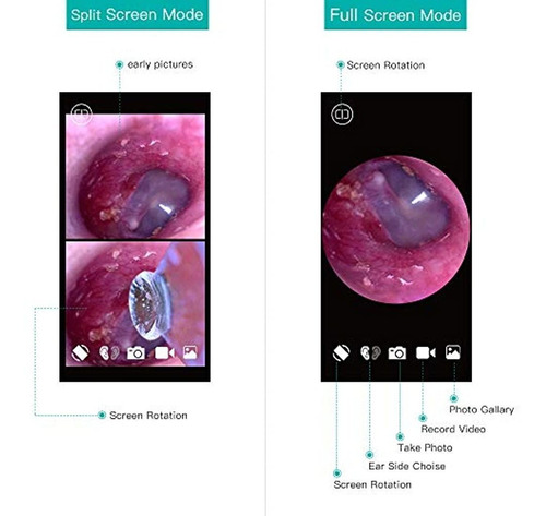 Otoscopio Inalámbrico Con Doble Vista, 0.154 in, 720phd, Wif