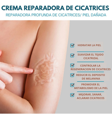 Crema Despigmentante De Manchas Para Cicatrices Paño Acne