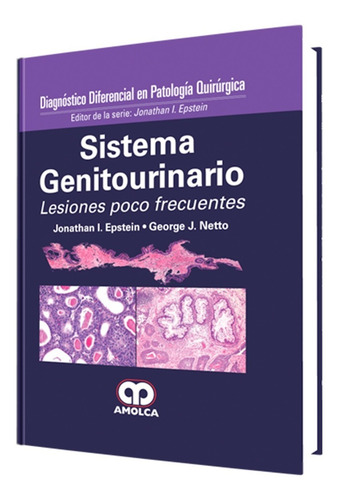 Diagnóst. Difer. En Patología Quirúrg Sistema Genitourinario