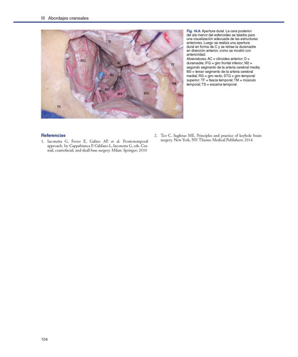 Anatomía Neuroquirúrgica Craneal Operatoria. Incluye E-book
