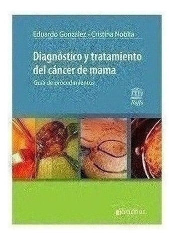 Diagnóstico Y Tratamiento Del Cáncer De Mama - González, Ed