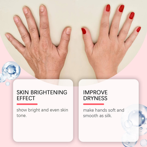 Corretor Para Manchas Escuras O Creme Facial Contra Manchas