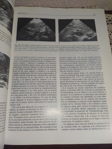 Ecografía Abdominal (Usado)