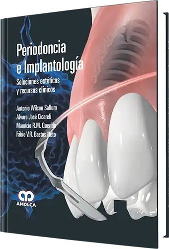 Periodoncia E Implantología Soluciones Estéticas Y Recur.cli