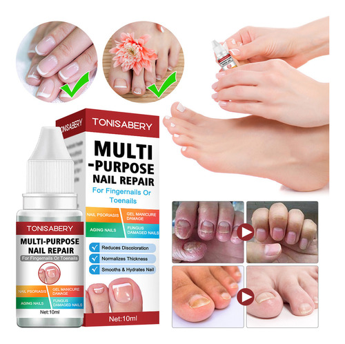 Serum Nutritivo Reparador De Hongos En Las Uñas De Los Pies,