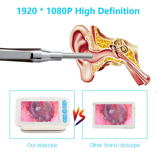 Imagen 3 de 9 de Otoscopio Digital Con 6 Luces Led 32g Tfcard 3.9mmm 1080p