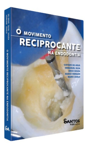 Livro O Movimento Reciprocante Na Endodontia