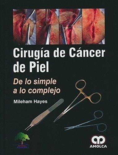 Cirugia De Cancer De Piel De Lo Simple A Lo Complejo