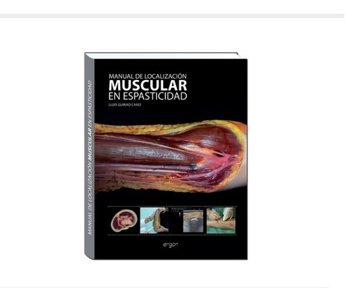 Manual De Localización Muscular En Espasticidad