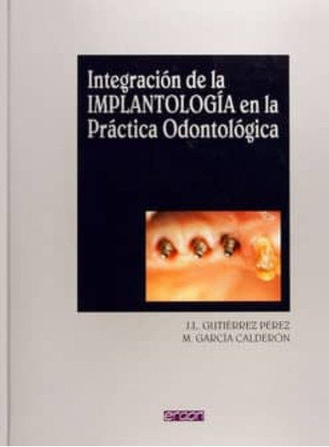 Integración De La Implantología En La Practica Odontológica 