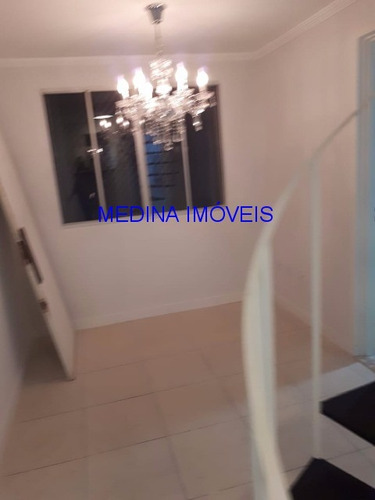 Imagem 21 de 21 de Apartamento Duplex - Ap00212 - 33767560