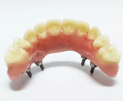 Dentista Mecanico Dental Protesis Dental Flexible Implante