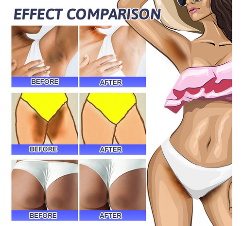 Crema Reparadora De Manchas Oscuras Uv Crema Para Axilas Adv