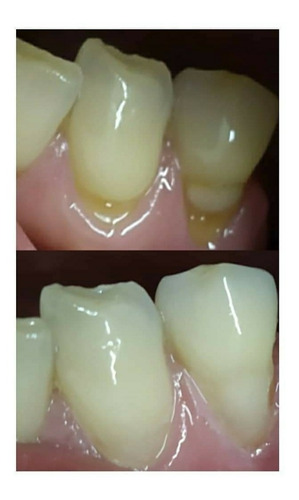 Imagen 7 de 10 de Consultorio Odontológico/ Dentista/ Prótesis Dentales