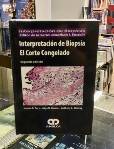 Interpretación De Biopsia El Corte Congelado 2da Ed.